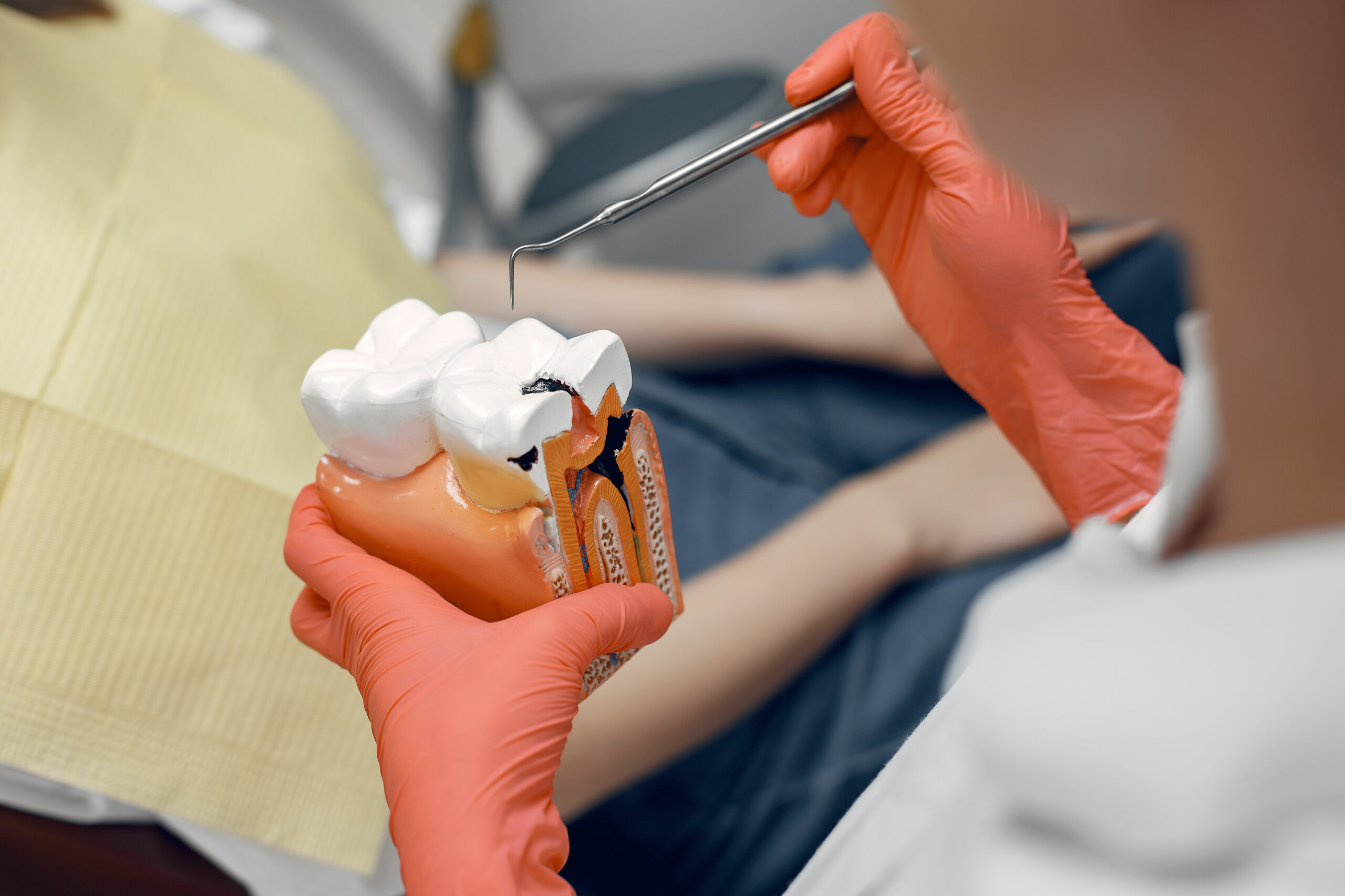 Root Canal treatment Pure Care