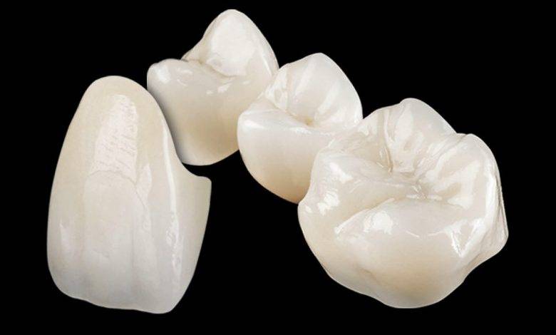 Zirconia bridges Pure care