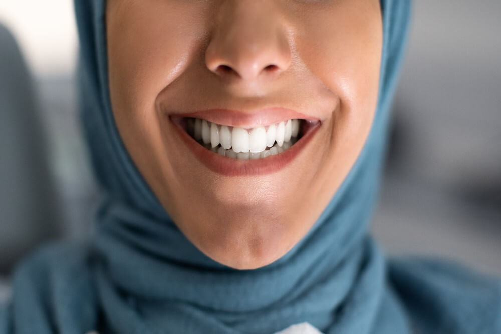 Most affordable teeth whitening in Abu Dhabi