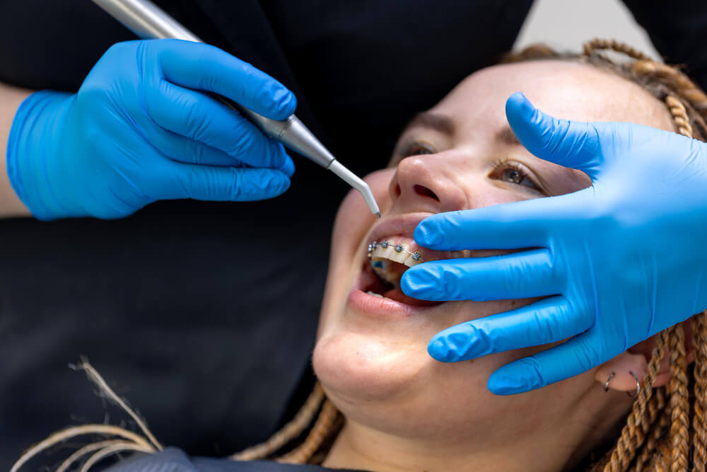 Most affordable dental braces Abu Dhabi