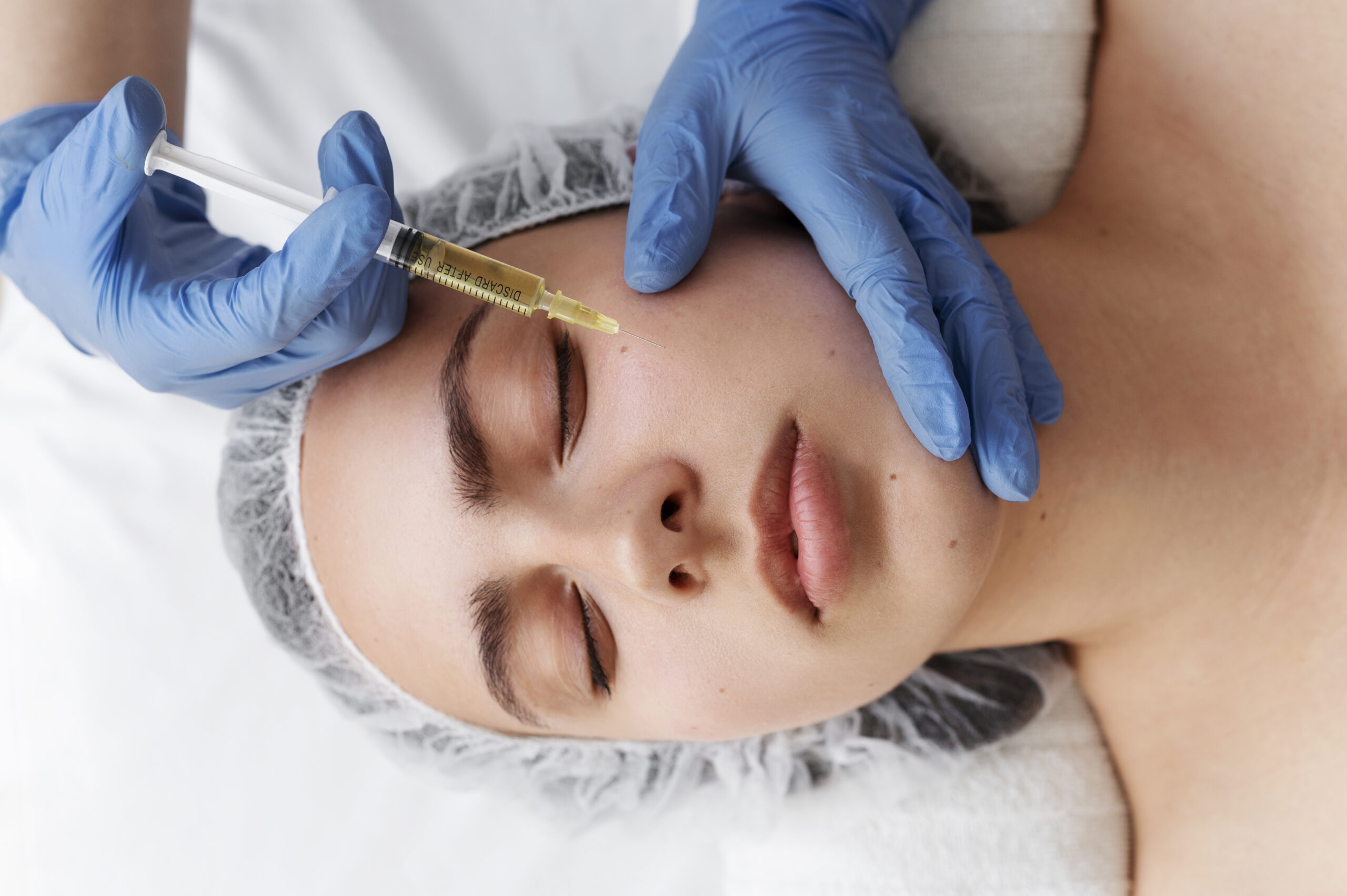 top-view-woman-getting-face-prp-treatment
